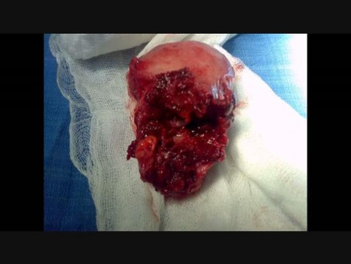 Wsparcie psychiczne po poronieniu