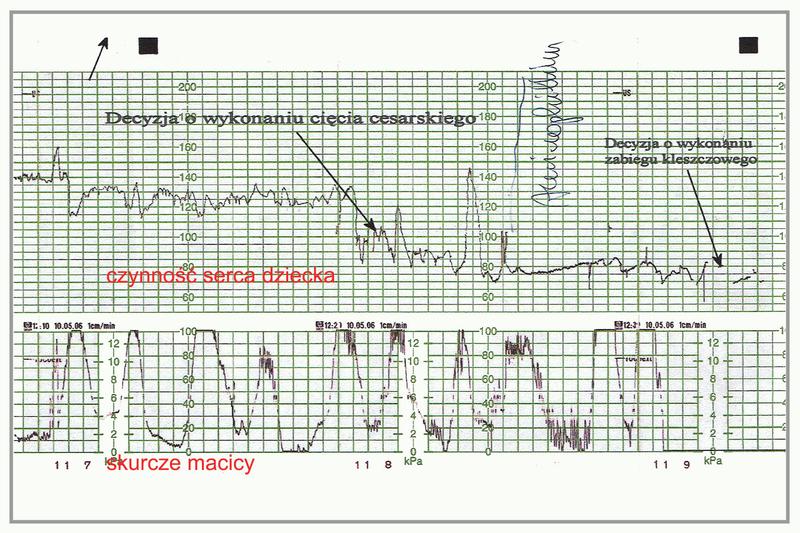 Kiedy najlepiej udać się na badanie KTG? Poradnik dla przyszłych mam